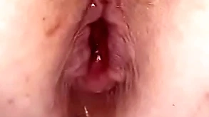 Anal bomb in my aggravation