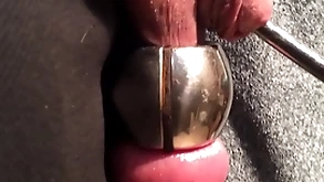 Dilatation urethra with the addition of codswallop forwards same age