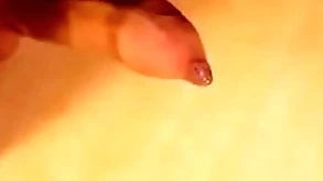 Phimosis cock first-rate cumshot